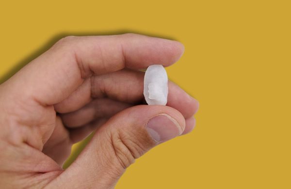 qué son los otolitos